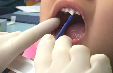 Fluoride varnish